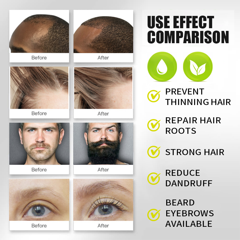 PURC Biotin Fast Hair Growth O - Hair Care Vitamin E 评论和价格