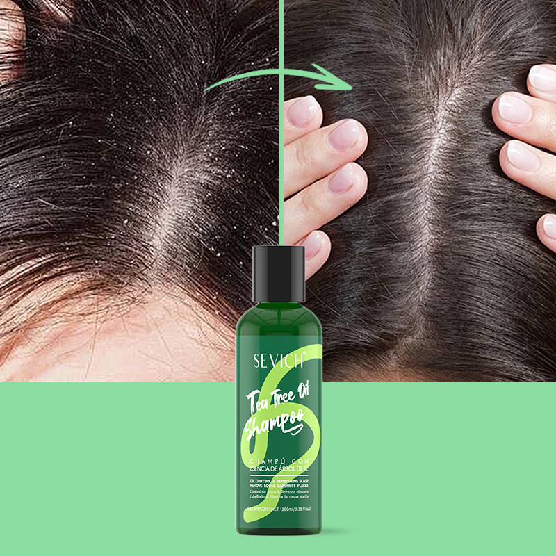 Tea Tree Essence Shampoo Hair  - Hair Care Set 评论和价格