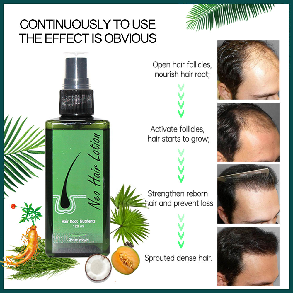 Original Neo Hair Lotion 120ml - Hair Care Thailand 评论和价格